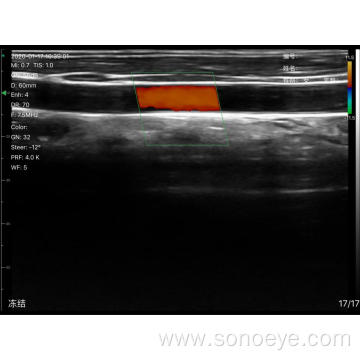 Super Width Linear Probe Type Wireless Mini Ultrasound